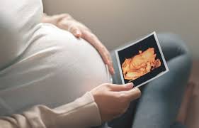 When Is the Best Time for a 4D Ultrasound? A Guide for Expecting Parents 